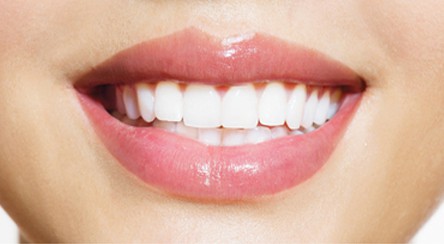 Ask us about whitening services